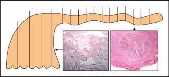 Figur 2. SEE-FIM protokoll. Gjenngitt med tillatelse. Gjengitt etter Crum et al. (2007). Copyright 2007 Wolters Kluwer Health, Inc.