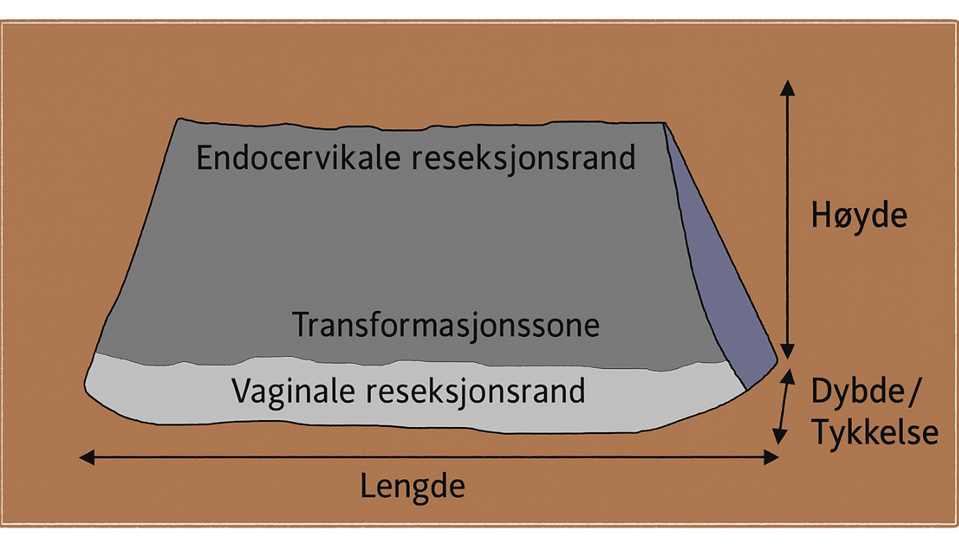 Figur 4: Orientering av oppklippet kon preparat.