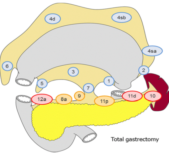 Total gastrectomy.png
