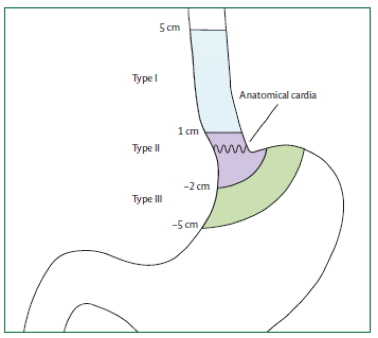 6.6 Innledning av kreft, bilde 1.png