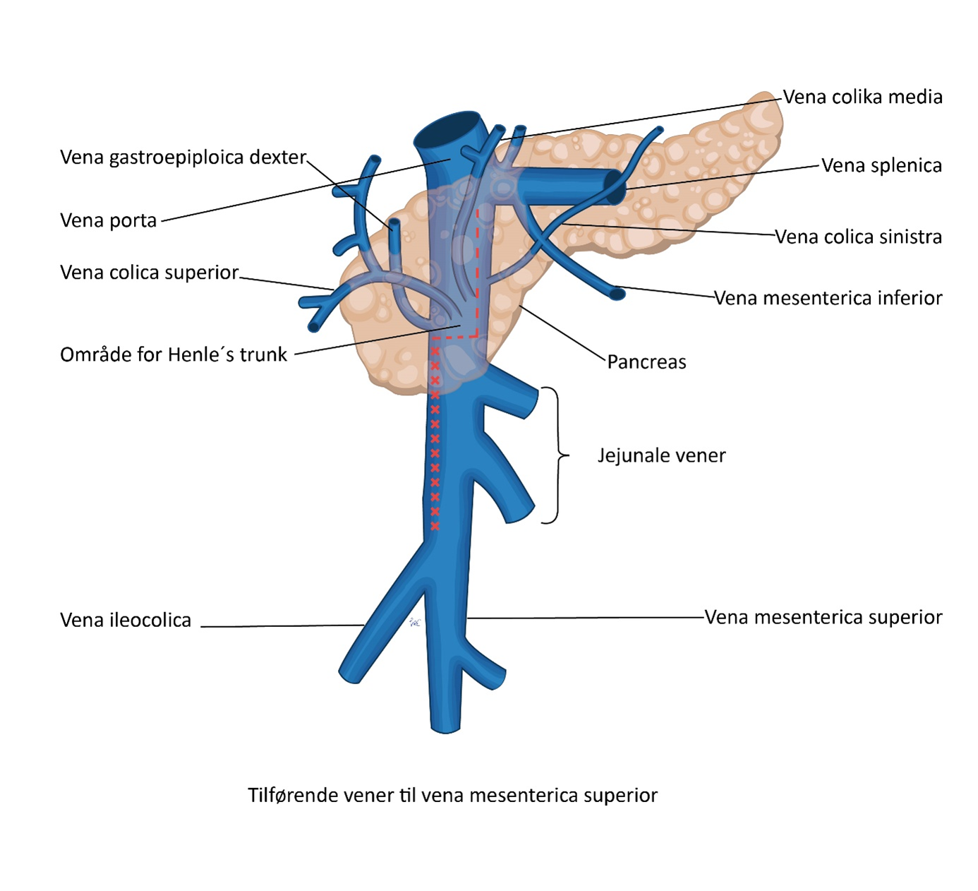 Figur 3: Veneanatomi ved høyresidig hemikolektomi. Den prikkete røde linjen viser hva som forstås med D2 komplett disseksjon der disseksjonen går inntil høyre kant av vena mesenterica inferior. Den stiplede røde linjen viser området for Henle´s trunk som kan ha mange varianter.