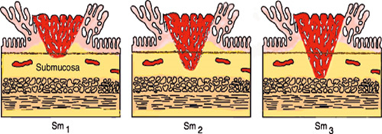 Figurene brukes etter tillatelse av Ellinor Moldeklev Hoff