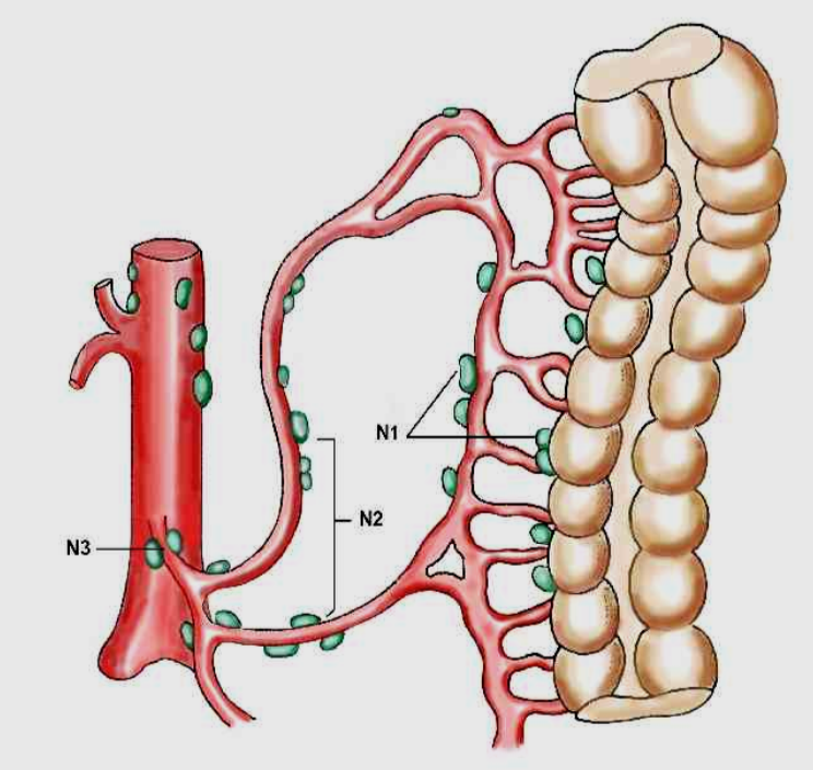 Tykk og endetarmskreft - Lymfeknutelokalisasjon N1-N3 for tykktarm.png