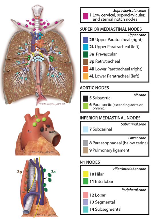 Kart over lymfeknutestasjoner