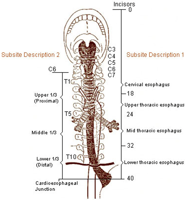 Spiserørskreft - Regionale lymfeknuter.png