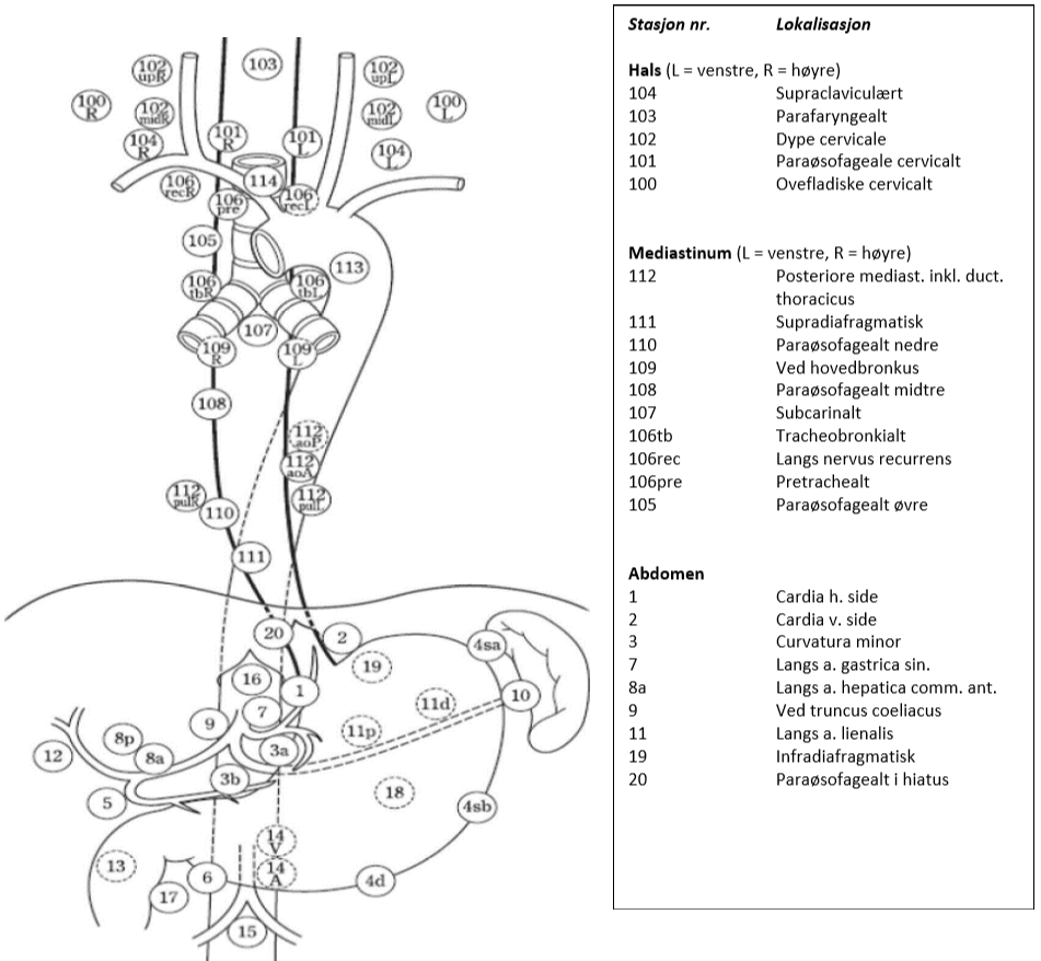 Spiserørskreft - Aktuelle glandelstasjoner ved spiserørskreft.png