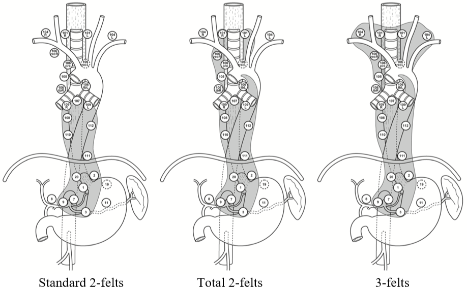 Spiserørskreft - Lymfeknutedisseksjonen.png