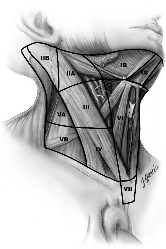 UICC / Robbins (nivå)